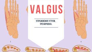 Вальгус . Valgus.  Тренировки.  Без Операции.  Гимнастика утром.